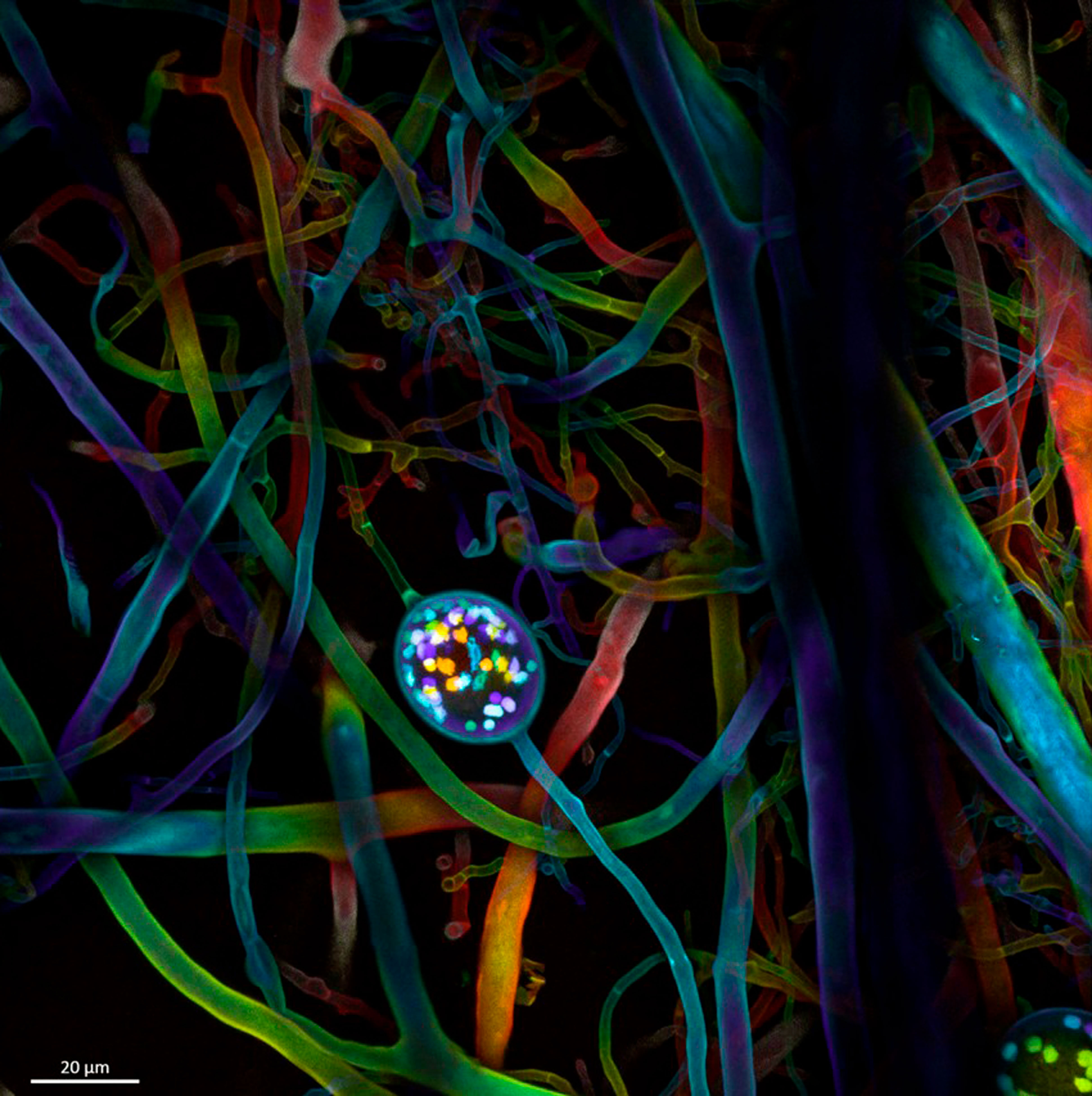 Многоядерные споры и гифы почвенного гриба — арбускулярный микоризный гриб