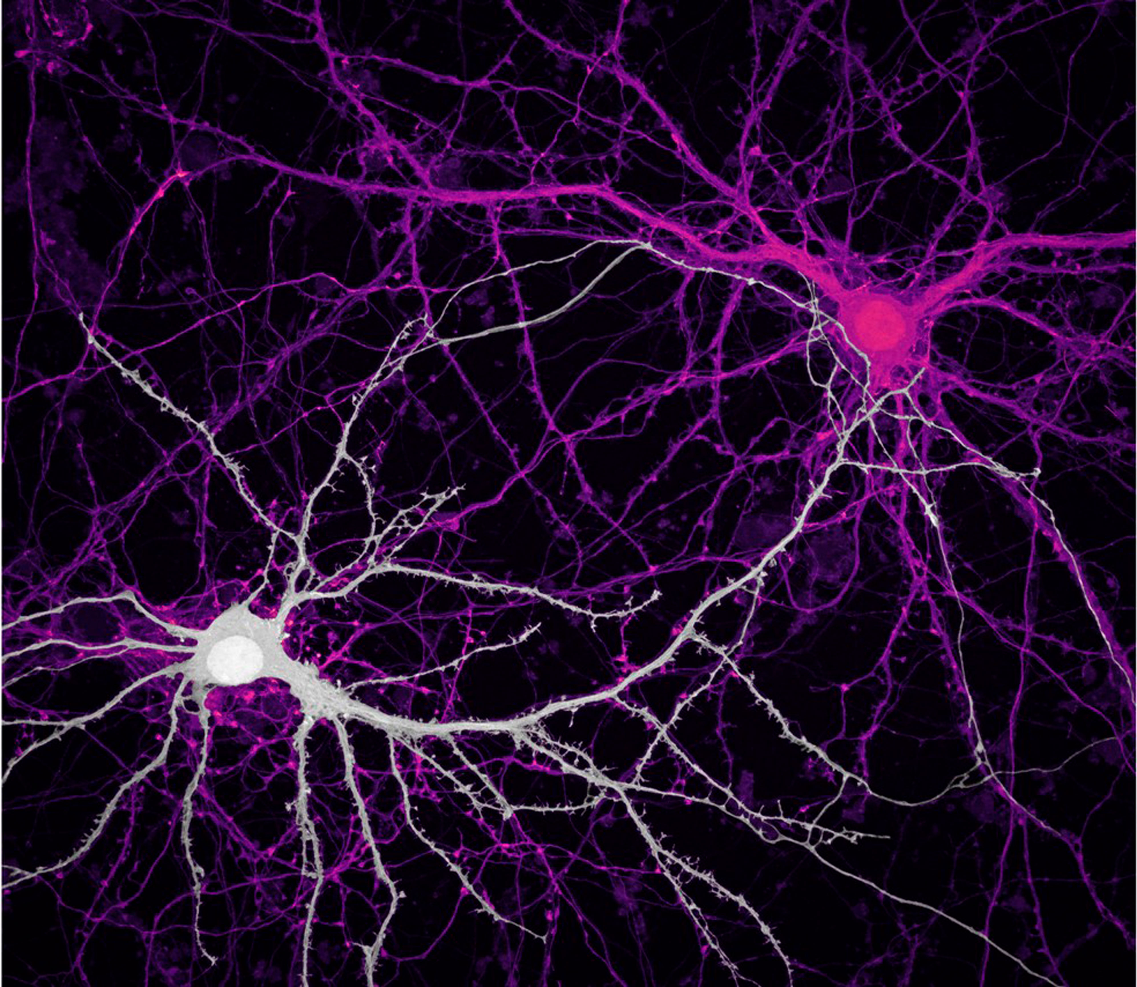 Связи между нейронами гиппокампа — клетки мозга