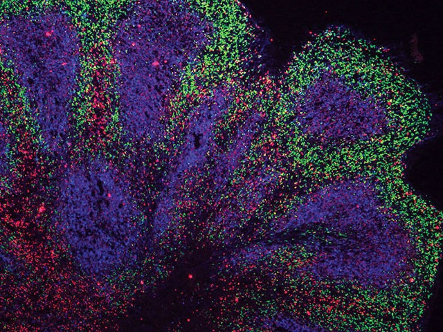 Ученые вырастили мини-мозг в лаборатории — он поможет понять, как развиваются болезни