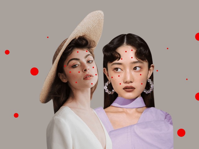  Акне: причины, стадии, как избавиться