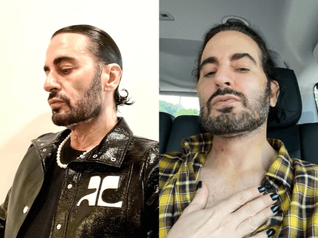 До и после: Марк Джейкобс сделал подтяжку лица 